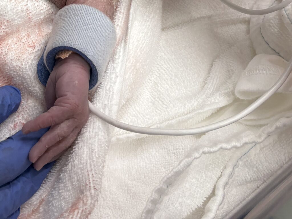 取り出された長女